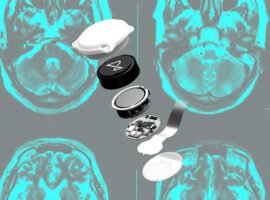 Did Neuralink make the wrong bet?